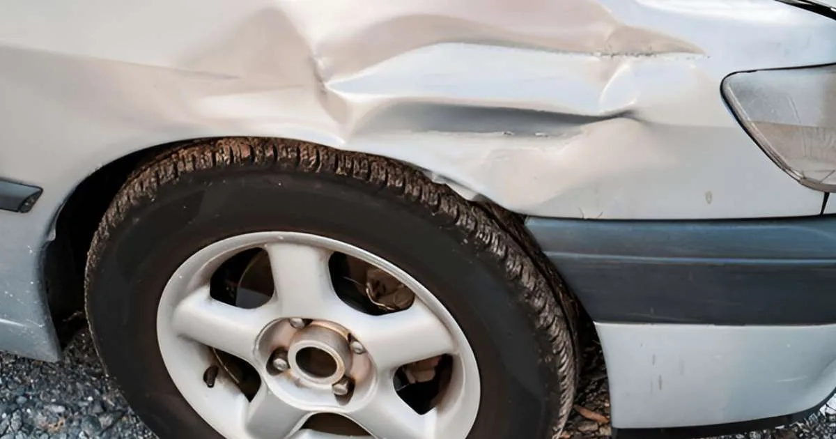 Diy Dent Removal Techniques